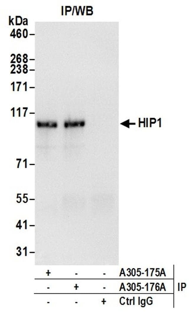 HIP1/Huntingtin-interacting Protein 1 Rabbit anti-Human, Polyclonal, Bethyl Laboratories